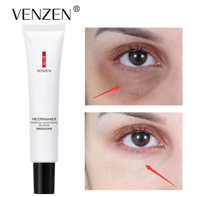 Venzen Eye Cream for Wrinkles | Under Eye Cream with Hyaluronic Acid and Nicotinamide | Reduce Fine Lines | 0.68 Fl Oz
