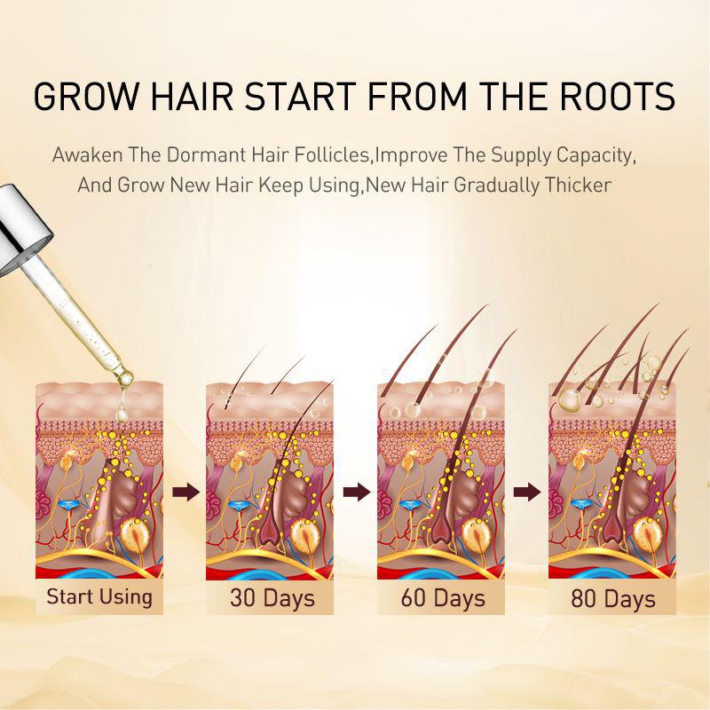PURC Ginger Hair Growth Products Prevent Hair Loss Essential Oil Fast Growing Scalp Treatment Beauty Health for Men Women