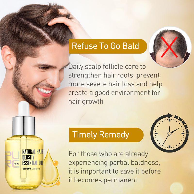 PURC Ginger Hair Growth Products Prevent Hair Loss Essential Oil Fast Growing Scalp Treatment Beauty Health for Men Women