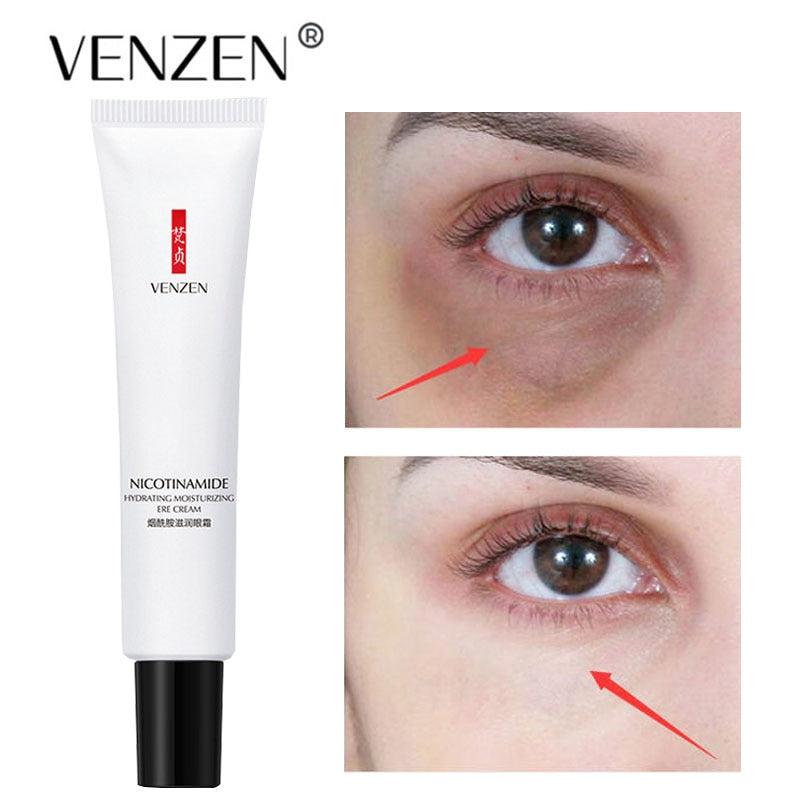 Venzen Eye Cream for Wrinkles | Under Eye Cream with Hyaluronic Acid and Nicotinamide | Reduce Fine Lines | 0.68 Fl Oz